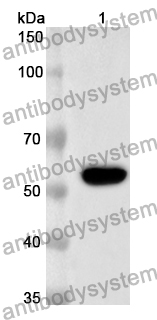 Anti-Nipah virus/HeV Protein N/Nucleoprotein Polyclonal Antibody